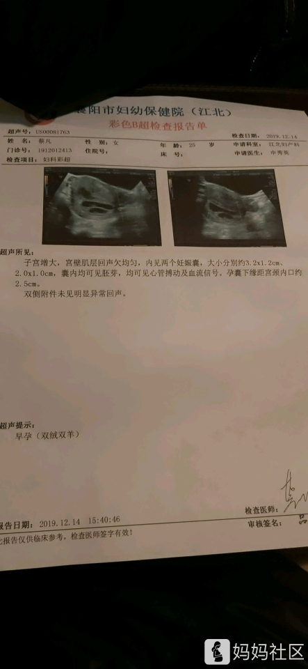 有会看双胎性别的吗?