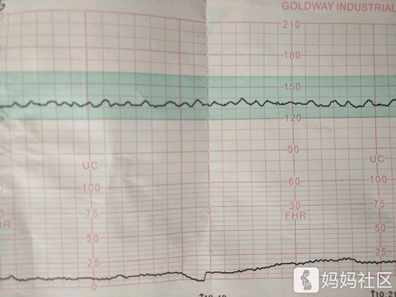 有谁能看懂胎心监护,有图