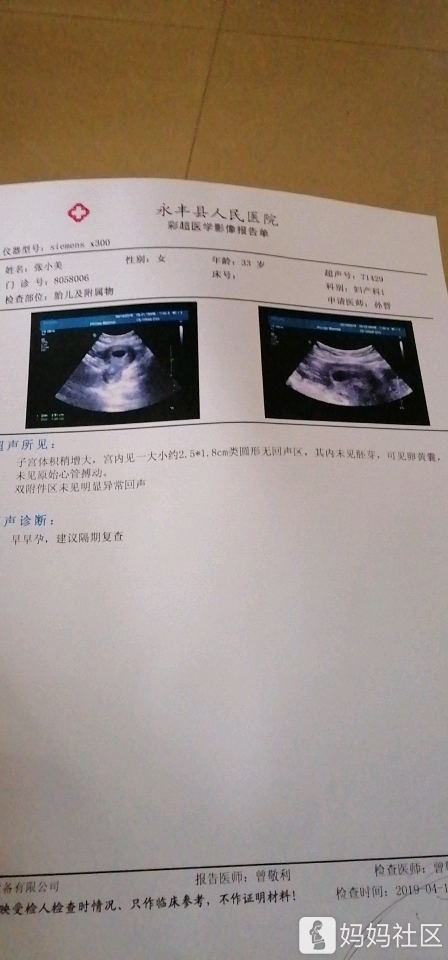 二胎着床出血