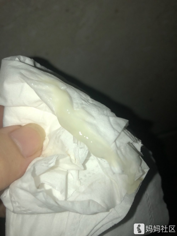 又有果冻状分泌物出现了