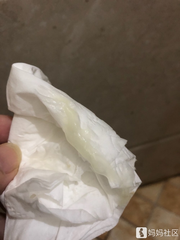 又有果冻状分泌物出现了