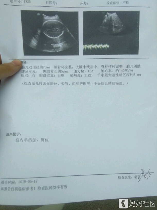 什么是臀位啊?