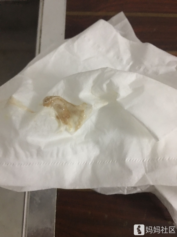 2个月宝宝拍嗝吐出褐色分泌物