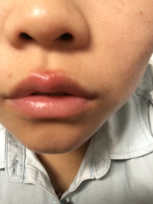 最近火很大嘴巴又长火泡了